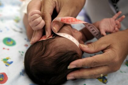 Audiência na Câmara discute cuidados com crianças que nasceram com microcefalia por causa do Zika vírus