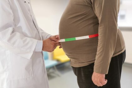 Comissão debate dificuldades no acesso ao diagnóstico e ao tratamento da obesidade