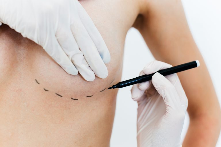 Nova lei amplia acesso a cirurgia reparadora de mama e apoio psicológico no SUS e em planos de saúde