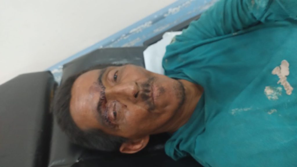 HPS João Lúcio pede ajuda para localizar familiares de um paciente que obteve alta hospitalar na unidade