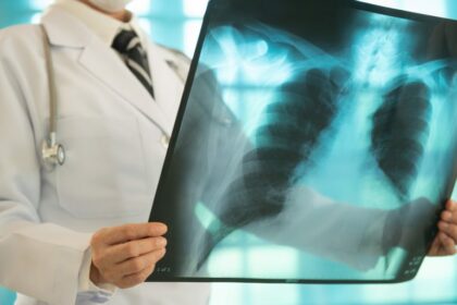 Comissões debatem impacto da doença pulmonar obstrutiva crônica na população idosa