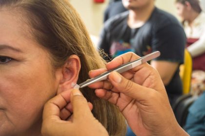Qualificação em auriculoterapia para servidores da saúde