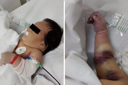 Caso envolvendo bebê de 1 mês e 5 dias reforça urgência do Protocolo Benício Xavier, de autoria da deputada Débora Menezes