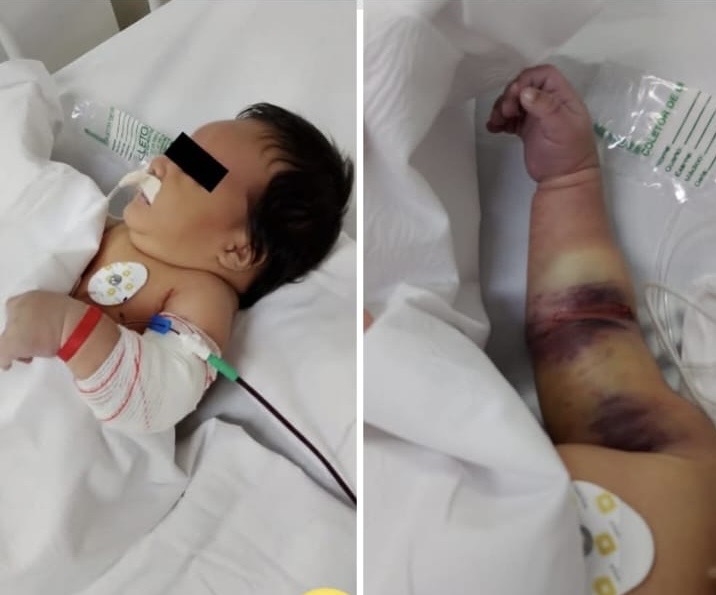 Caso envolvendo bebê de 1 mês e 5 dias reforça urgência do Protocolo Benício Xavier, de autoria da deputada Débora Menezes