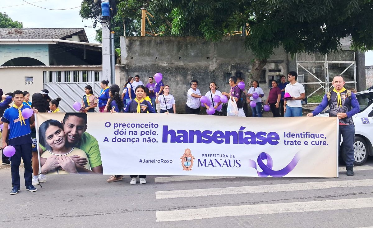 Caminhada na zona Leste de Manaus encerra campanha ‘Janeiro Roxo’ no controle e prevenção da hanseníase