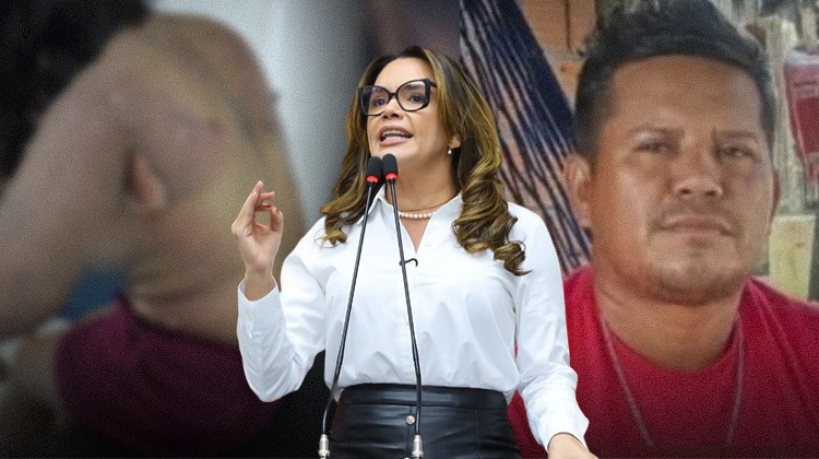 Alessandra Campelo garante apoio da Procuradoria da Mulher à vítima de tentativa de feminicídio em Parintins